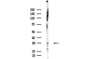 Western blot analysis of lysates from MCF7 cells(heat-shock,45 min treatment), using Phospho-Syntaxin 1A (Ser14) Antibody at 1/1000 dilution.