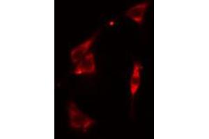 ABIN6274917 staining Hela cells by IF/ICC. (BST2 anticorps  (Internal Region))