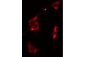 ABIN6274917 staining Hela cells by IF/ICC.