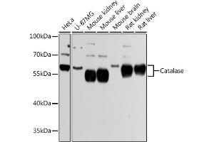 Western blot analysis of extracts of various cell lines, using Catalasealase Antibody (ABIN6133450, ABIN6137987, ABIN6137989 and ABIN6215464) at 1:3000 dilution. (Catalase anticorps  (AA 1-225))
