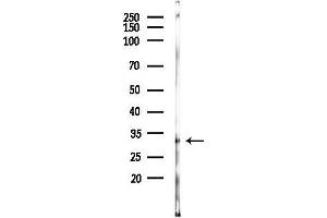 Western blot analysis of lysates from Rat liver, using DR5 Antibody at 1/1000 dilution.