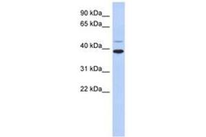 Image no. 1 for anti-Ring Finger Protein 121 (RNF121) (AA 215-264) antibody (ABIN6743182) (RNF121 anticorps  (AA 215-264))