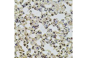 Immunohistochemistry of paraffin-embedded mouse lung using POT1 antibody (ABIN5970699) at dilution of 1/100 (40x lens). (POT1 anticorps)