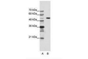 Image no. 1 for anti-Host Cell Factor C1 (VP16-Accessory Protein) (HCFC1) (AA 91-140) antibody (ABIN203129) (HCFC1 anticorps  (AA 91-140))