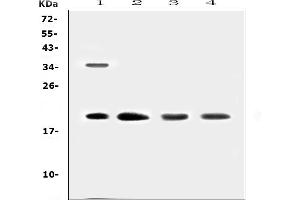 Western blot analysis of Dermatopontin using anti-Dermatopontin antibody (ABIN5692846).