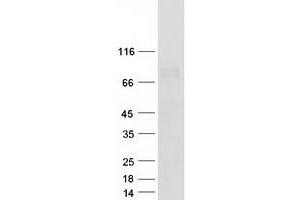 Validation with Western Blot