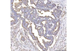IHC analysis of PLP2 using anti-PLP2 antibody (ABIN7600320).