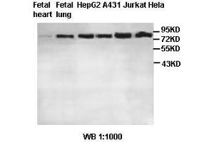 Image no. 2 for anti-MRE11 Meiotic Recombination 11 Homolog A (S. Cerevisiae) (MRE11A) antibody (ABIN791214) (Mre11 anticorps)