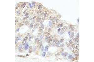 Immunohistochemistry (IHC) image for anti-Histone Deacetylase 7 (HDAC7) (AA 425-475) antibody (ABIN7454533)