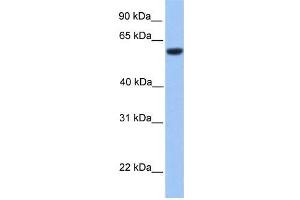 Human Brain; WB Suggested Anti-ZNF545 Antibody Titration: 0. (Zinc finger protein 82 homolog (ZFP82) (C-Term) anticorps)