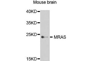 Western blot analysis of extract of various cells, using MRAS antibody. (MRAS anticorps)