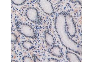 Used in DAB staining on fromalin fixed paraffin- embedded stomach tissue