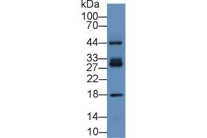 Detection of ICAM2 in Human Hela cell lysate using Polyclonal Antibody to Intercellular Adhesion Molecule 2 (ICAM2) (ICAM2 anticorps  (AA 27-248))