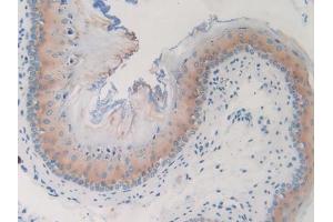 IHC-P analysis of Mouse Esophagus, with DAB staining. (GNG8 anticorps  (AA 1-70))