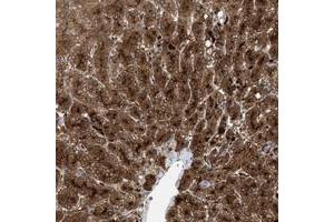Immunohistochemical staining of human liver with MBTD1 polyclonal antibody  shows strong cytoplasmic positivity in hepatocytes.