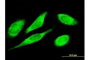 Immunofluorescence of purified MaxPab antibody to MTDH on HeLa cell.