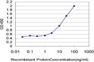 anti-Interleukin 22 Receptor, alpha 1 (IL22RA1) (AA 19-574) antibody