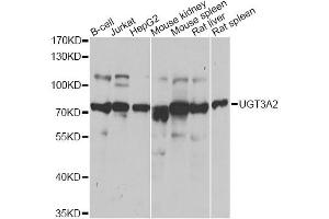 Western blot analysis of extracts of various cell lines, using UGT3A2 antibody (ABIN2560665) at 1:1000 dilution. (UGT3A2 anticorps)