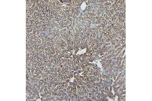 IHC analysis of IFNAR2 using anti-IFNAR2 antibody (ABIN7601353). (IFNAR2 anticorps  (AA 33-466))