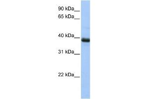 WB Suggested Anti-SPO11 Antibody Titration: 0. (SPO11 anticorps  (N-Term))