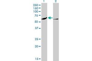 Western Blot analysis of CAMK4 expression in transfected 293T cell line by CAMK4 monoclonal antibody (M01), clone 1A3. (CAMK4 anticorps  (AA 1-473))