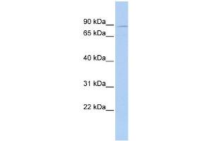 WB Suggested Anti-MEFV Antibody Titration:  0. (MEFV anticorps  (N-Term))