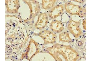 Immunohistochemistry of paraffin-embedded human kidney tissue using ABIN7145636 at dilution of 1:100 (RHD anticorps  (AA 32-76))