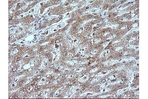 Image no. 3 for anti-Mitogen-Activated Protein Kinase Kinase 1 (MAP2K1) antibody (ABIN1499381)