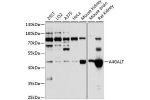Western blot analysis of extracts of various cell lines, using GALT antibody (ABIN6131973, ABIN6136304, ABIN6136305 and ABIN6224802) at 1:1000 dilution.