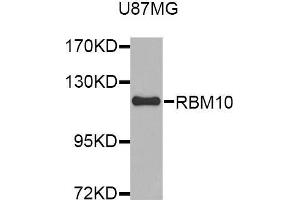 Western blot analysis of extracts of U87MG cell line, using RBM10 antibody. (RBM10 anticorps  (AA 1-180))