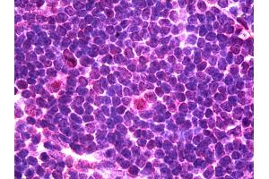 anti-NK2 Homeobox 3 (NKX2-3) (C-Term) antibody