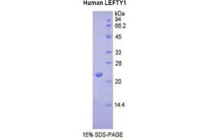SDS-PAGE analysis of Human LEFTY1 Protein. (LEFTY1 Protéine)