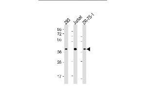All lanes : Anti-HIF1AN Antibody (C-term) at 1:4000 dilution Lane 1: 293 whole cell lysate Lane 2: Jurkat whole cell lysate Lane 3: ZR-75-1 whole cell lysate Lysates/proteins at 20 μg per lane.