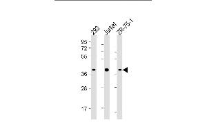 All lanes : Anti-HIF1AN Antibody (C-term) at 1:4000 dilution Lane 1: 293 whole cell lysate Lane 2: Jurkat whole cell lysate Lane 3: ZR-75-1 whole cell lysate Lysates/proteins at 20 μg per lane. (HIF1AN anticorps  (AA 1-349))