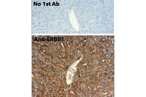 Immunohistochemistry (IHC) image for anti-Epidermal Growth Factor Receptor (EGFR) (C-Term) antibody (ABIN6254171) (EGFR anticorps  (C-Term))