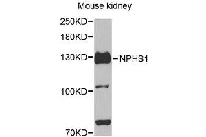 Western blot analysis of extracts of mouse kidney, using NPHS1 antibody (ABIN5971560) at 1/500 dilution. (Nephrin anticorps)