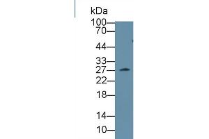 Western Blot; Sample: Mouse Serum; Primary Ab: 1µg/ml Rabbit Anti-Mouse CLTA Antibody Second Ab: 0. (CLTA anticorps  (AA 5-234))