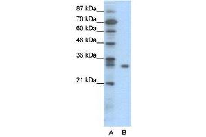 WB Suggested Anti-NFKBIB  Antibody Titration: 0. (NFKBIB anticorps  (N-Term))