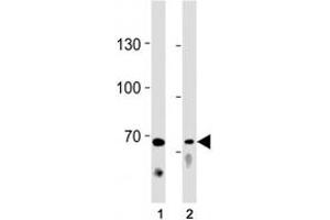 TICAM1 antibody western blot analysis in (1) Ramos cell line and (2) mouse liver tissue lysate.