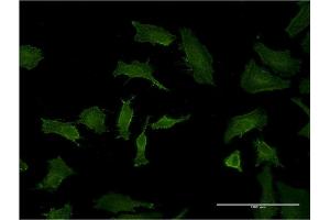 Immunofluorescence of monoclonal antibody to BID on HeLa cell. (BID anticorps  (AA 1-195))