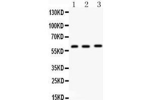 Anti-FMO5 antibody, Western blotting All lanes: Anti FMO5  at 0.