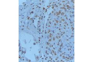 Formalin-PBS and Bouin embedded paraffin human renal tissue pretreated with heat induced epitope retrieval Citrate buffer pH 6. (GREM1 anticorps  (C-Term))