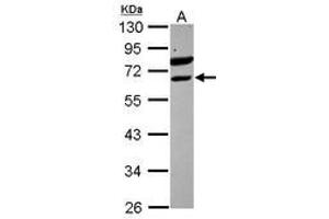 Image no. 1 for anti-Ets Variant 6 (ETV6) (AA 1-191) antibody (ABIN1498133) (ETV6 anticorps  (AA 1-191))