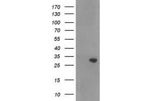 Western Blotting (WB) image for anti-Ras Association (RalGDS/AF-6) Domain Family Member 5 (RASSF5) antibody (ABIN1500615) (RASSF5 anticorps)