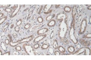 Detection of COL1a2 in Human Kidney Tissue using Polyclonal Antibody to Collagen Type I Alpha 2 (COL1a2) (COL1A2 anticorps  (AA 1103-1366))