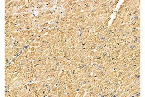 ABIN6261686 and ABIN6278857 at 1/100 staining Rat heart tissue by IHC-P.