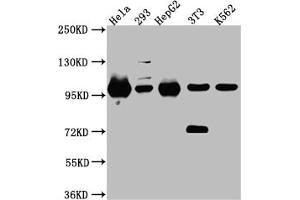 Western Blot Positive WB detected in: Hela whole cell lysate, 293 whole cell lysate, HepG2 whole cell lysate, NIH/3T3 whole cell lysate, K562 whole cell lysate All lanes: STAT6 Antibody at 1:1000 Secondary Goat polyclonal to rabbit IgG at 1/50000 dilution Predicted band size: 95, 75, 82 kDa Observed band size: 100 kDa