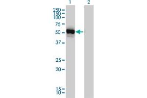 Western Blot analysis of GPT expression in transfected 293T cell line by GPT monoclonal antibody (M03), clone 4E2. (ALT anticorps  (AA 1-496))