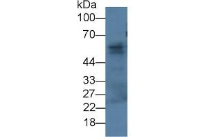 Detection of FBLN3 in Rat Skin lysate using Monoclonal Antibody to Fibulin 3 (FBLN3) (FBLN3 anticorps  (AA 26-213))