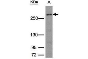 WB Image Sample (30μg whole cell lysate) A:293T whole cell lysate 5% SDS PAGE antibody diluted at 1:1500 (CAD anticorps  (C-Term))